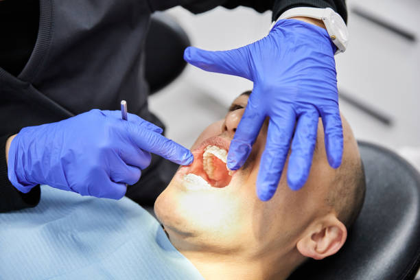 Best Root Canal Emergency Dentist  in Dickinson, TX